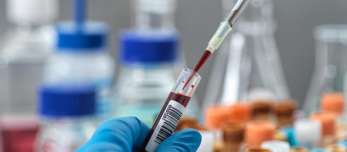 Immunoglobulines G (IgG) : définition, rôle, dosage